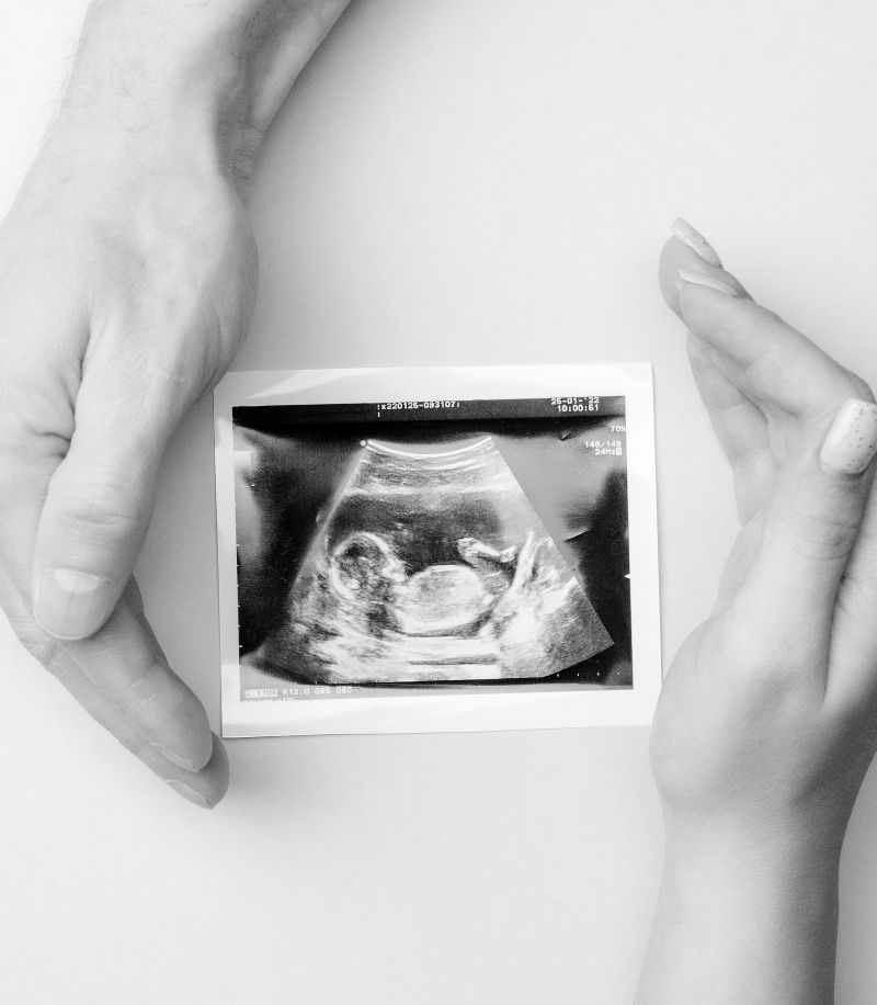 Services-Ultrasound-Pic